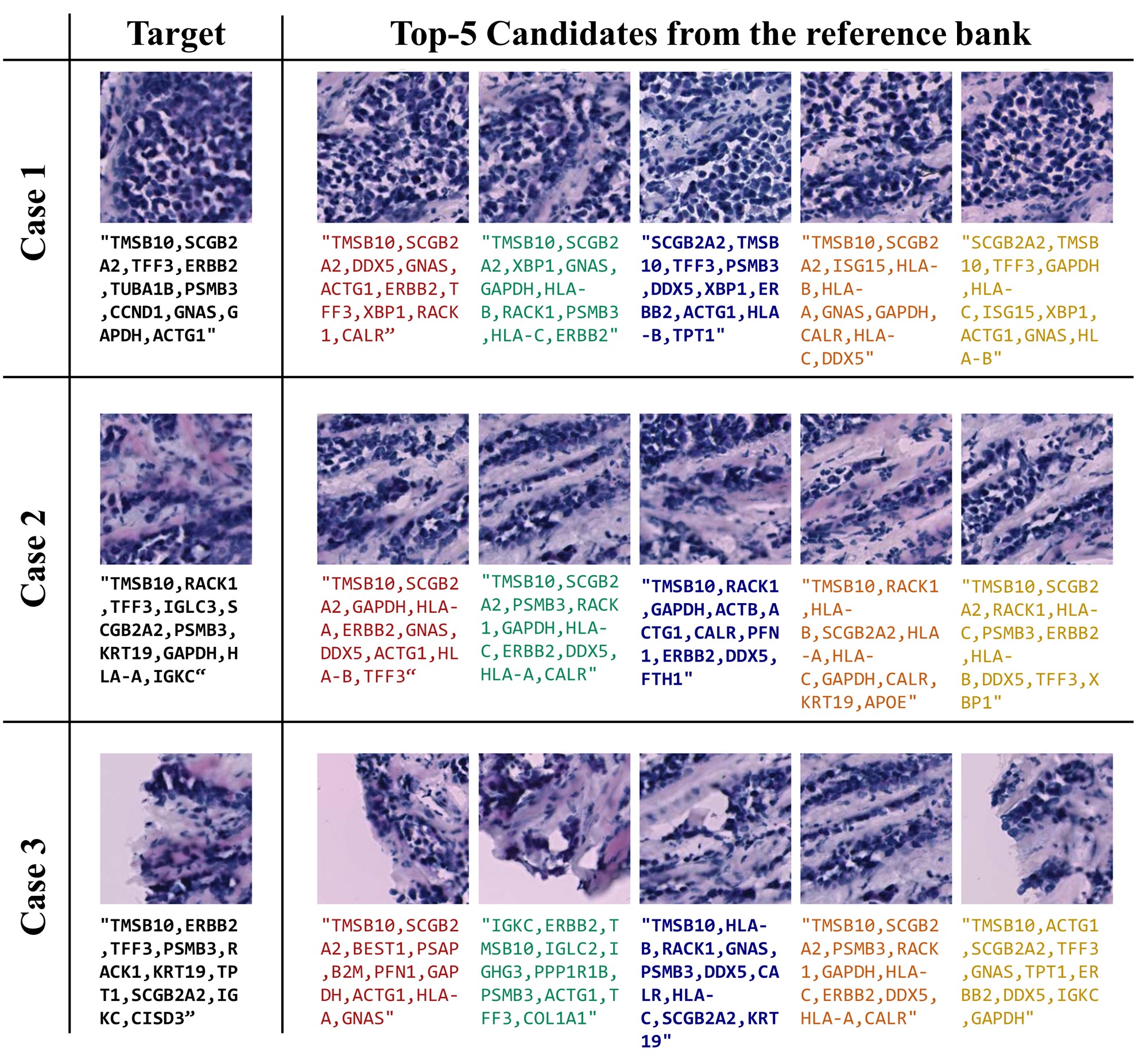 Top-5 retrieved reference patches sharing morphological and transcriptomic profiles